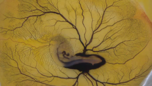 Anna Franz, Winner of Nikon Small World 2011