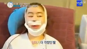Korean Plastic Surgery Magic at AutoCurate.com